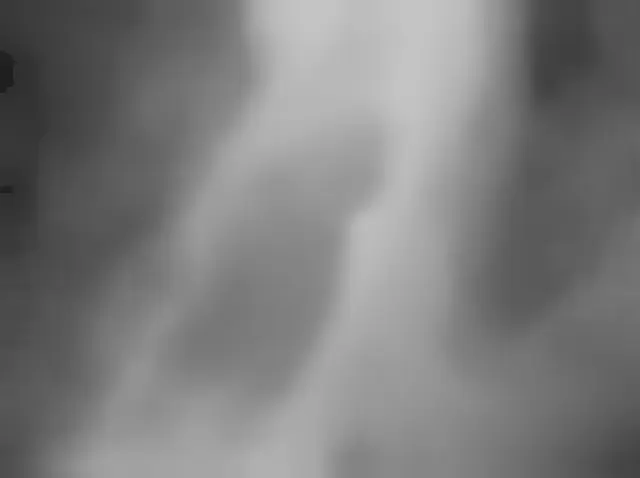 Sol 303: Mars Hand Lens Imager (MAHLI)