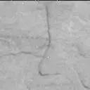 Sol 2416: Mast Camera (Mastcam)