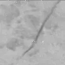 Sol 3165: Mast Camera (Mastcam)